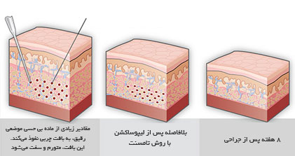 سشیس