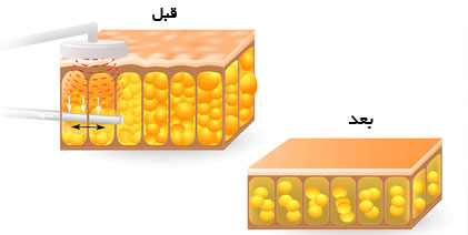 طزرطز